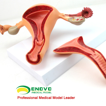 VENDER 12442 Estructura uterina Anatomical Model Anatomy Reproductive System